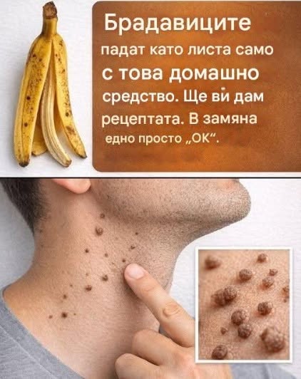 Брадавиците падат като листа само с това домашно приготвено лечение. Ето рецептата. Едно просто „ОК“ е всичко, от което се нуждаете.